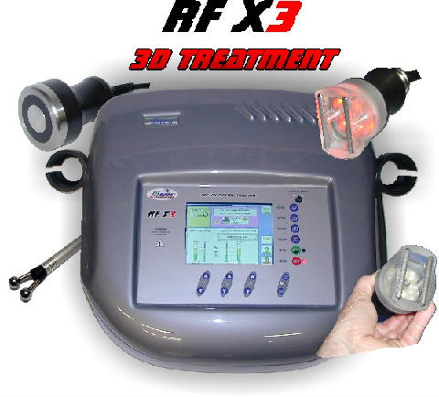 RFX3D-3 